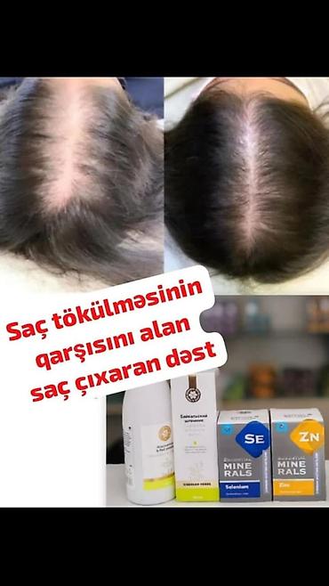 эсвицин цена в баку: Saç tökülməsinə qarşı kompleks dəst Məhsul tərkibi: - Şampun — 1