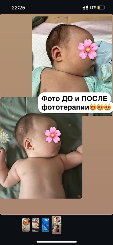 наруто вещи: ✅СЕРТИФИЦИРОВАНАЯ✅БЕЗОПАСНАЯ, НОВАЯ ФОТОЛАМПА 🔆Ваш малыш страдает от — 1