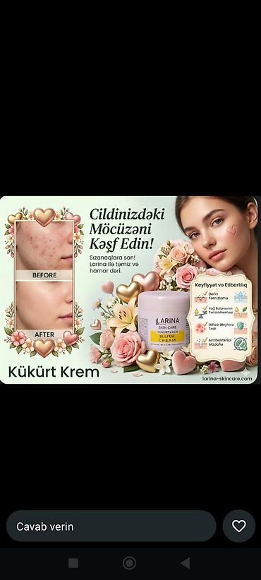 Üz kremləri və serumları: Üz serumu, Akneyə meyilli dəri üçün — 5