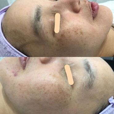 Косметология: Косметология, Чистка кожи, Биоревитализация, Пилинг, Сертифицированный косметолог, Гипоаллергенные материалы, Консультация — 3