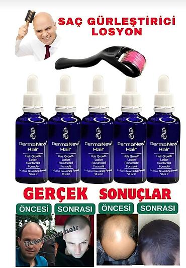 Gözəllik və sağlamlıq: Saç tökülməsinə qarşı vasitə Yeni — 4