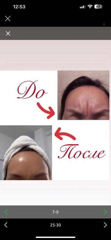 Косметология: Косметология, Биоревитализация, Ботокс, Демодекоз, Гипоаллергенные материалы, Консультация, Сертифицированный косметолог — 9