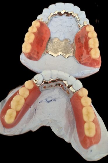 diş protezleri qiymetleri: Stomatologiya