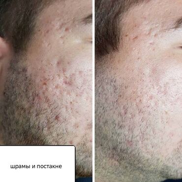 Косметология: Косметология, Пилинг, Ботулинотерапия, Плазмолифтинг, Консультация, Требуются модели, Сертифицированный косметолог — 12