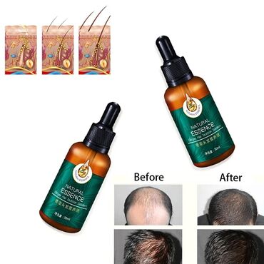 Другая техника для красоты и здоровья: Zenshow ginger hair nutrition solution 30ml 100% натуральный продукт