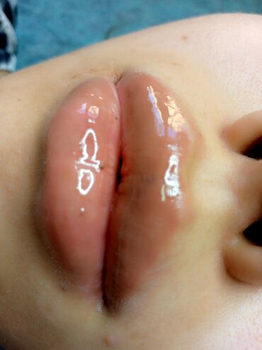 Косметология: Косметология, Биоревитализация, Ботулинотерапия, Контурное моделирование, Гипоаллергенные материалы, Консультация, Сертифицированный косметолог — 16