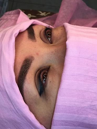 Косметология: Косметология, Ботокс, Биоревитализация, Ботулинотерапия, С выездом на дом, Консультация, Гипоаллергенные материалы — 2