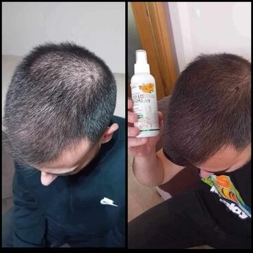 Nega kose: KosaLim 💚 Kosalim je kombinacija prirodnih ekstrakta lekovitog bilja na lalafo.rs — 9 Nega kose: KosaLim 💚 Kosalim je kombinacija prirodnih ekstrakta lekovitog bilja — 9