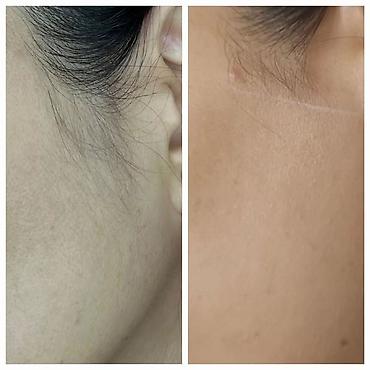 Эпиляция: Восковая депиляция для женщин и мужчин Подмышки - 500 сом — 7