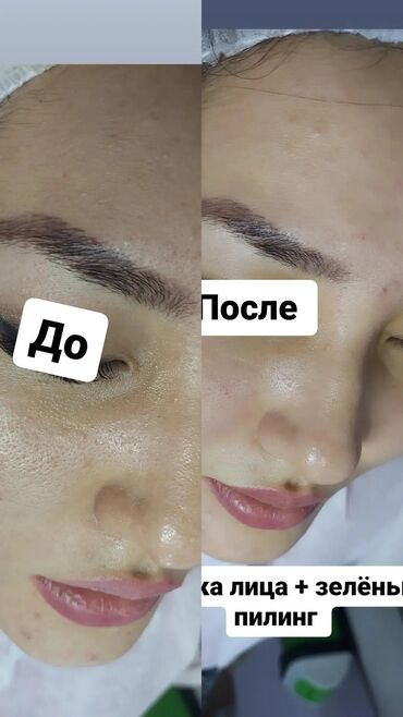 Косметология: Косметолог с медицинским образованием чистка лица пилинг осветление — 3