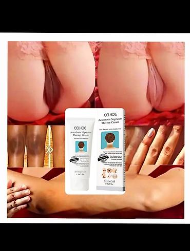 krem a e: Eelhoe firmasının supper ağardıcı krem #bikini ağardıcı #qolaltı — 7