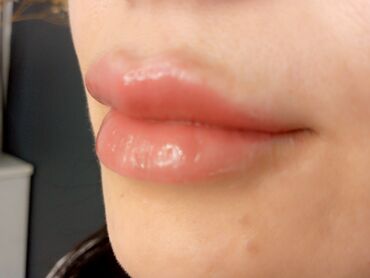 Косметология: Косметология, Биоревитализация, Ботулинотерапия, Контурное моделирование, Гипоаллергенные материалы, Консультация, Сертифицированный косметолог — 11