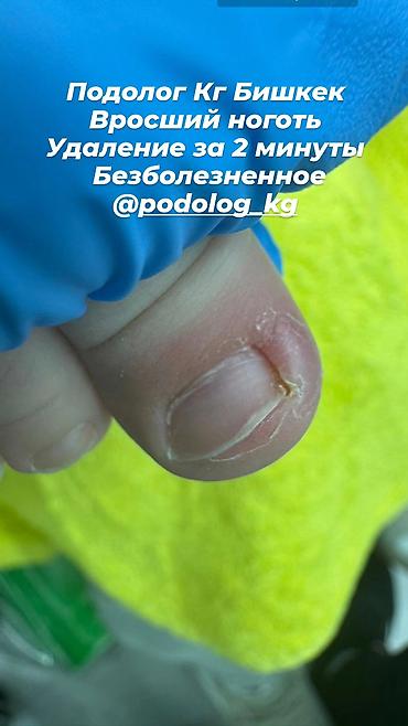 падолог: Коррекция вросших ногтей, Маникюр, Педикюр, Услуги подолога, Консультация, Одноразовые расходные материалы — 2