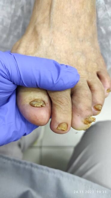 Маникюр, педикюр: Наращивание ногтей, Гель лак, шеллак, Укрепление ногтей, Услуги подолога, Маникюр, Педикюр, Консультация, Одноразовые расходные материалы — 7