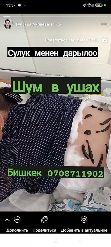 живота: Врачи | Гирудотерапевт | Лечение пиявками — 2