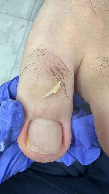 Маникюр, педикюр: Коррекция вросших ногтей, Педикюр, Услуги подолога, Консультация, Одноразовые расходные материалы — 13