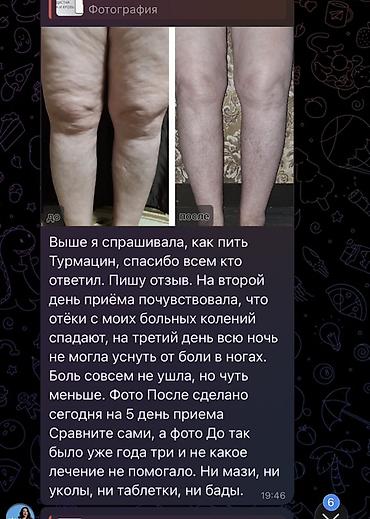 atomy: ✨ Турмацин MSM Atomy — забота о суставах и движении каждый день! — 3