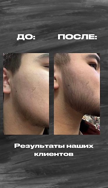 ред: Сыворотка для роста волос и бороды RIJAL REAXIDIL 15% - Активный — 2