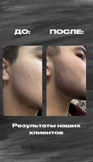 Косметика: Средство для роста волос и бороды - Назначение: усиление роста щетины — 2