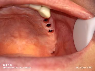 Медицинские услуги: Клиника | Стоматолог | Протезирование — 16