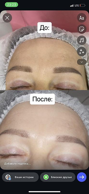 по коже: Косметология, Чистка кожи, Консультация — 1