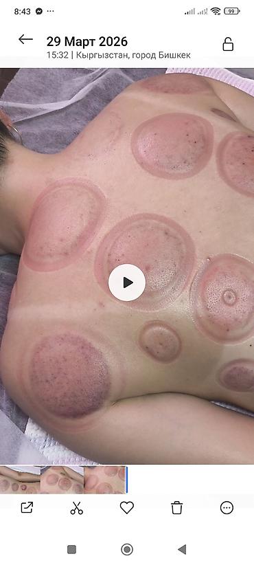 Массаж: Массаж | Лечебный массаж | Холка на шее, Подвывих сустава — 5