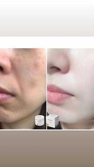 kosmetika qabı: Məhsul: Y-Peel Lightening Cream – ləkə qarşıtı və dəri tonu — 3