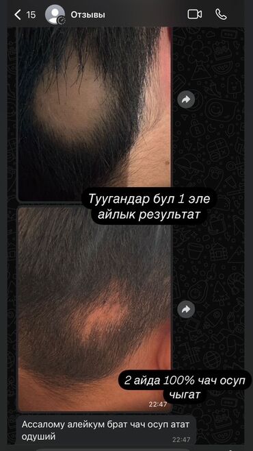 Косметика: Средство для роста волос и бороды - Назначение: усиление роста щетины — 8