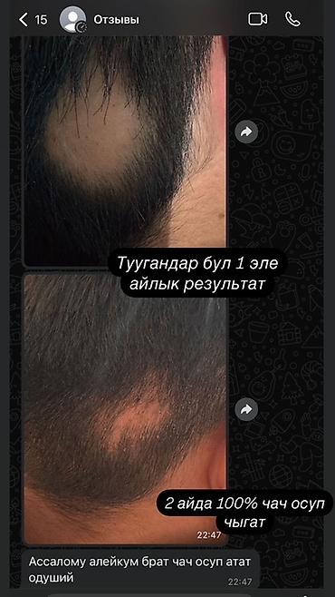 етор: Сыворотка для роста волос и бороды REAXIDIL 10% Minoxidil, 50 мл - — 3