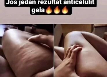 tople jakne za zimu: 🔥Vreme je da koža prodiše!🔥 Zategnuto. Glatko. Samopouzdano