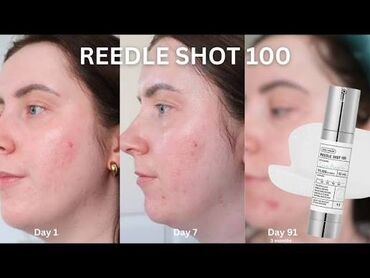 Косметика: 🔥 НАБОР (2шт сыворотки и увлажняющий крем)Reedle Shot Duo Set — — 5