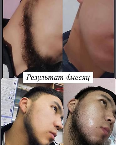 Уход за телом: Рост борода и волосы, киркланд оригинал✅из США оптом и розница +996 — 4