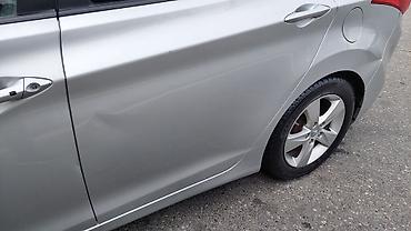 Hyundai Elantra: 1.8 l | 2011 il Sedan