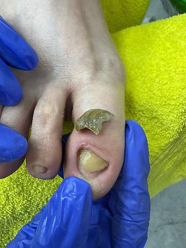 Маникюр: Коррекция вросших ногтей, Услуги подолога, Маникюр, Педикюр, Услуга в 4 руки, Одноразовые расходные материалы, Консультация — 12