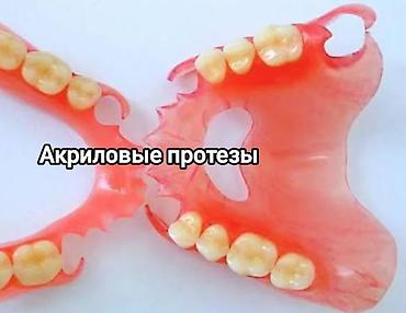 Стоматологи: Съёмные зубные протезы под ваши задачи - Вакуумные протезы: плотная — 6