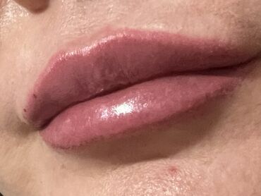 Косметология: Косметология, Маски, Мезотерапия, Удаление носогубных складок, Гипоаллергенные материалы, Консультация, Сертифицированный косметолог — 73