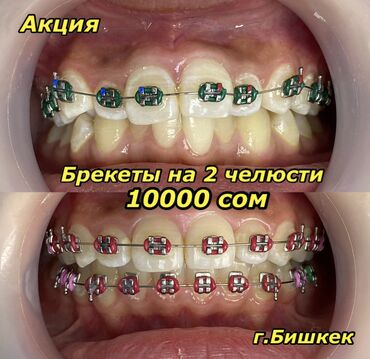 требуется ассистент стоматолога в Кыргызстан | СТОМАТОЛОГИ: Стоматолог | Брекет системы, пластинки | Консультация