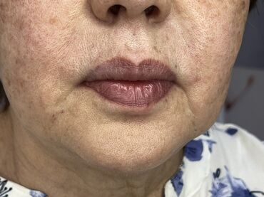 Косметика: Процедура перманентного макияжа губ позволяет придать губам желаемый — 11