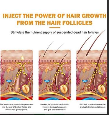 Уход за телом: США От облысения для волос от выпадения волос - смотрим фото читаем — 8