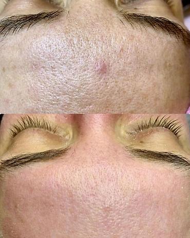 Косметология: Косметология, Чистка кожи, Массаж лица, Лечение угревой болезни, С выездом на дом, Сертифицированный косметолог, Консультация — 8