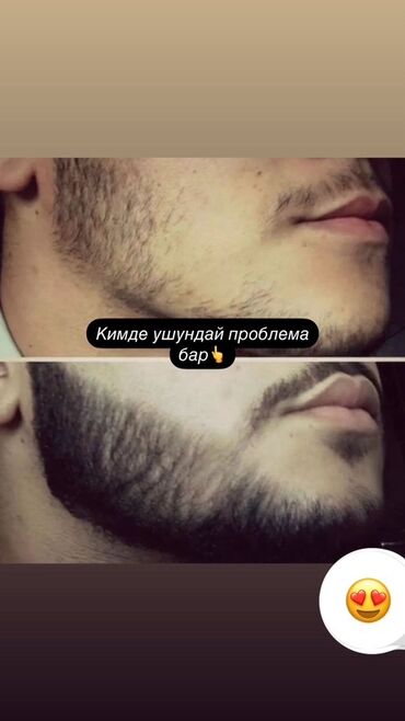 Косметика: Средство для роста волос и бороды - Назначение: усиление роста щетины — 9