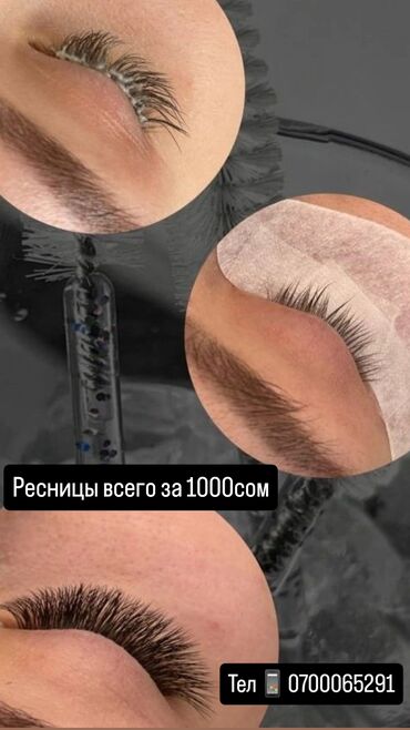 художественная реставрация зубов композитными материалами: Кирпиктер, Классика, Үйүнө баруу менен
