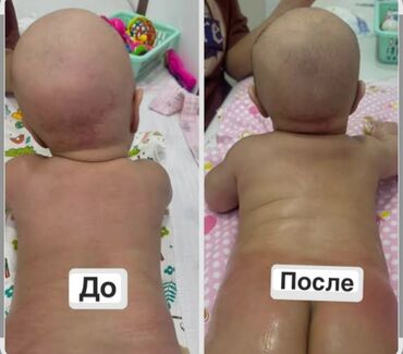 массаж фохоу: Дисплазия гипертонус гипатонус вальгус кривошея сколиоз ДЦП ЛФК