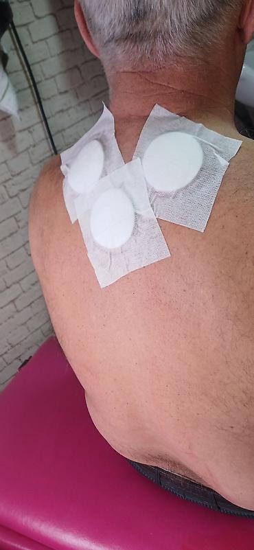 Hicama, zəli: HİCAMA EDİRƏM 30 AZN bankalar 1 dəfəlikdir sonra atilir 1 seansa 7 — 3