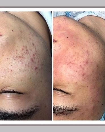 Косметология: Косметология, Чистка кожи, Массаж лица, Лечение угревой болезни, С выездом на дом, Сертифицированный косметолог, Консультация — 9