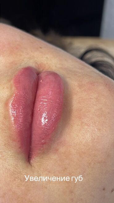 Косметология: Косметология, Биоревитализация, Ботокс, Демодекоз, Гипоаллергенные материалы, Консультация, Сертифицированный косметолог — 30