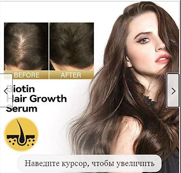 Уход за телом: США От облысения для волос от выпадения волос - смотрим фото читаем — 6