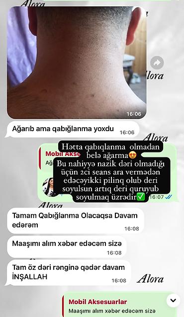 Boyun və kürək nahiyəsində qaralmanın açılması üçün peşəkar pilinq