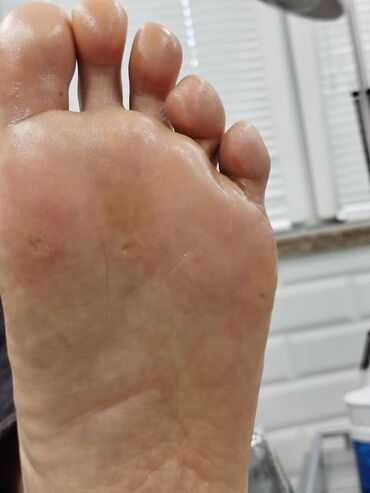 Маникюр, педикюр: Коррекция вросших ногтей, Педикюр, Услуги подолога, Консультация, Одноразовые расходные материалы — 10