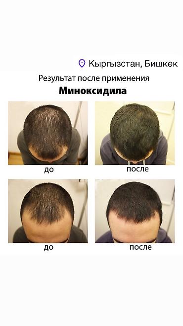 Уход за телом: Рост борода и волосы, киркланд оригинал✅из США оптом и розница +996 — 3